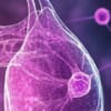 HR+/HER2+転移乳がんへのパルボシクリブ＋トラスツズマブのOS（PATRICIA）／ESMO Open
