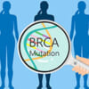 乳がんのs<i>BRCA</i>変異とg<i>BRCA</i>変異、生物学的特徴と治療反応が異なる／ESMO Open